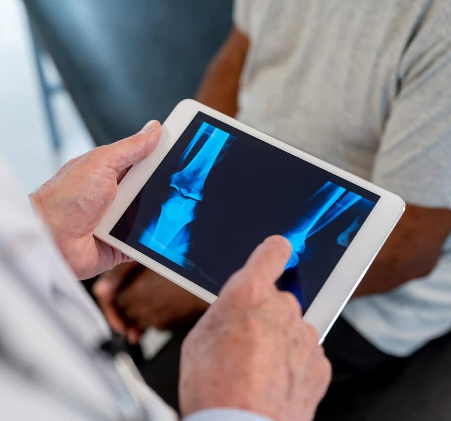 Close up of orthopedist looking at an x-ray 
